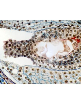 Desarrollo del saco embrionario de lirio