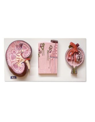 Riñón, corpúsculo renal y nefrona