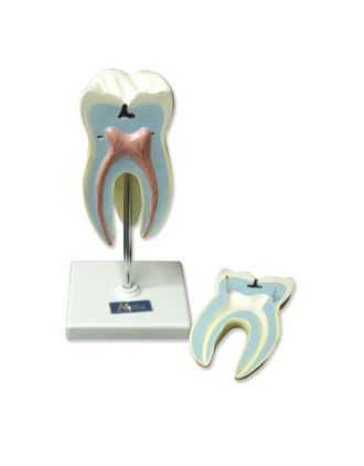 Foto molar con 3 raices