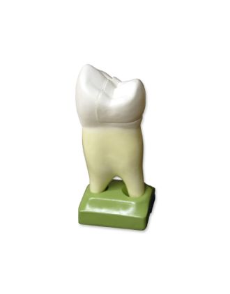 Premolar superior con 2 raíces, abierto