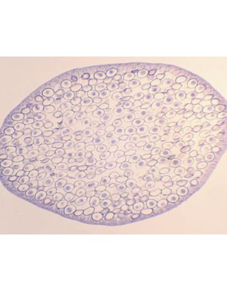 Testículo de locusta (langosta), sec.