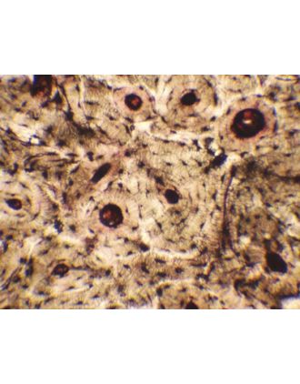 Extensión de sangre humana