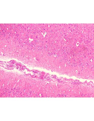 Terminación nervio motor, conejo, m.e.