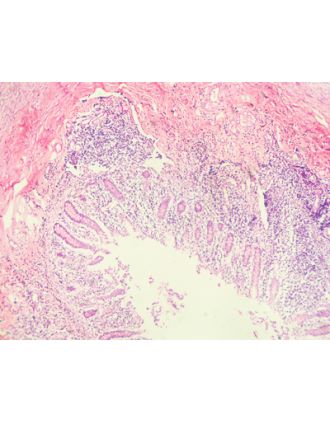 Sección de apéndice