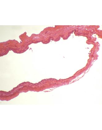 Arteria y vena, s.t.