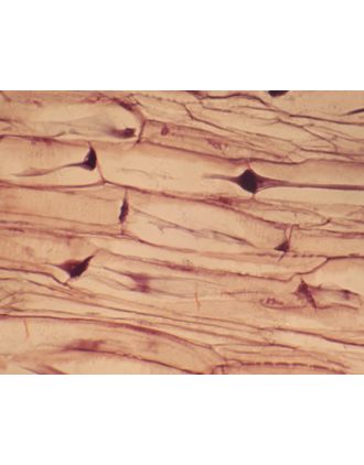 Peciolo de Morus alba, capa de abscisión, s.l.