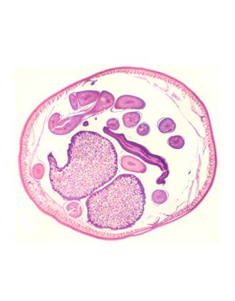 Hembra de áscaris, s.t.