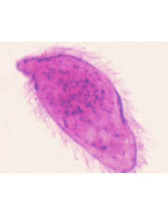 Miracidio de Schistosoma, m.e.